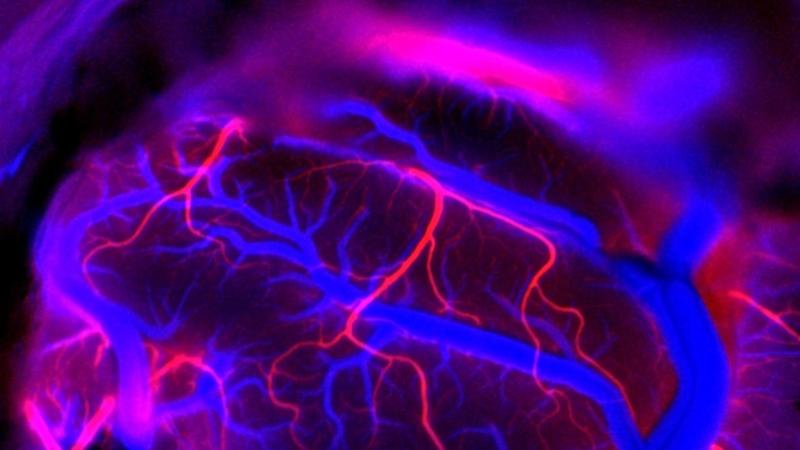 Neuralink cerebro Elon Musk