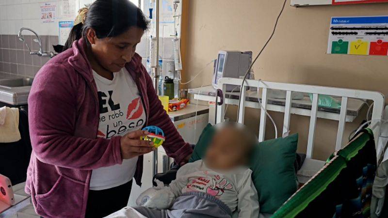 Craneoplastía de una bebé