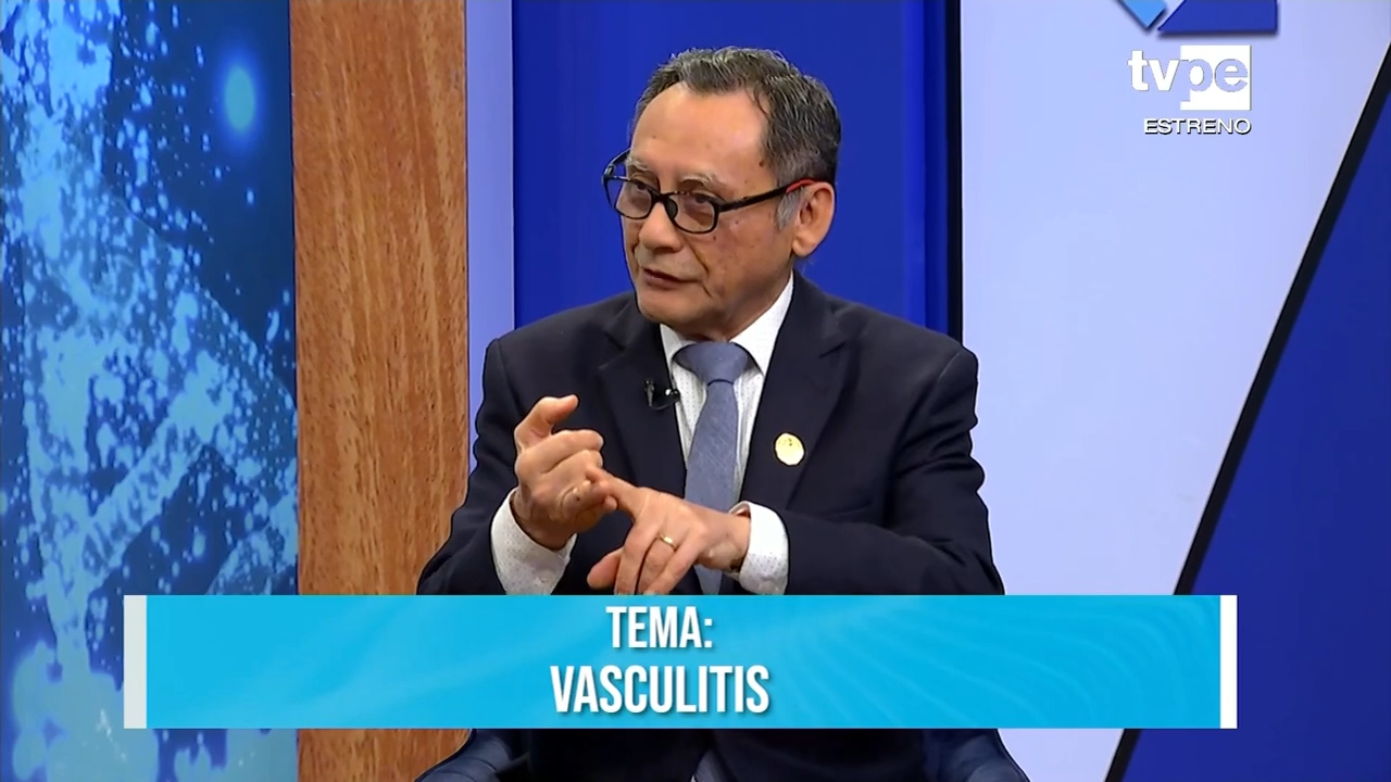 Vasculitis