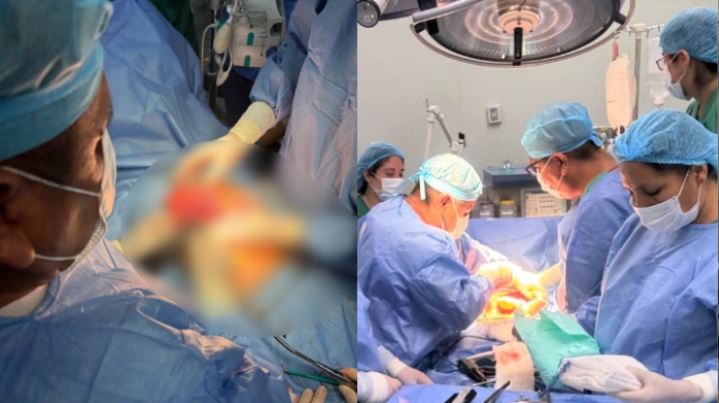 Cáncer de estómago